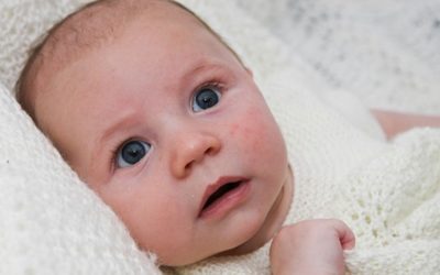 Ekcem kod dece – noćna mora za roditelje?