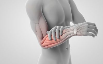 Julska akcija za pacijente sa bolom u ramenu, laktu, šaci